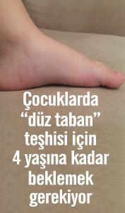 Düz taban teşhisi için 4 yaşına kadar beklemek gerekiyor